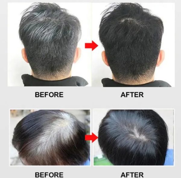 New Imported Apple Hair Color 72H Natural Black Ammonia Free – 30ml Each (Pack of 10) - Image 4